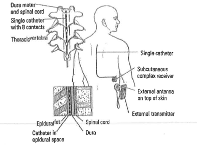 spinal diagram of a human